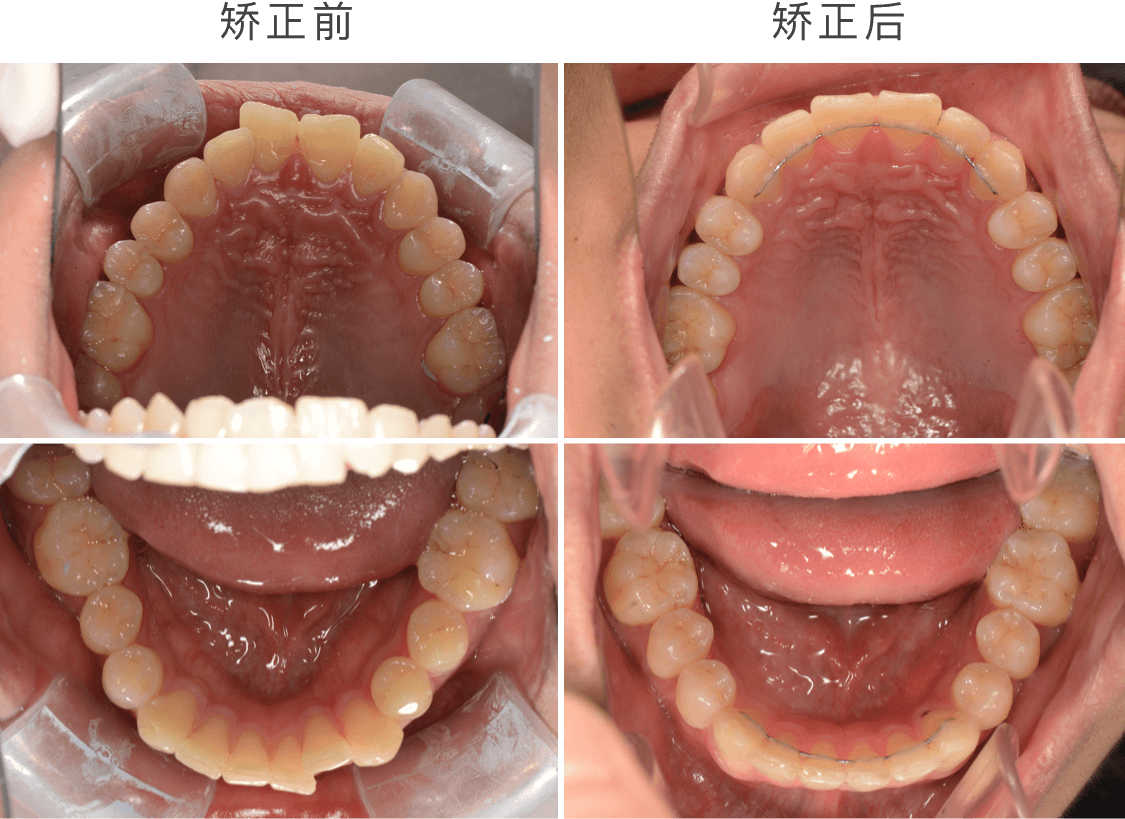 "比起颜值,我更关注的还是咬合健康"