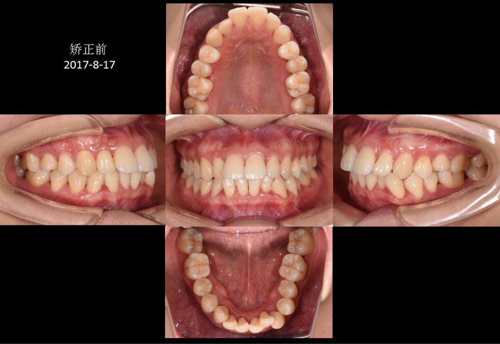 抹去抿嘴笑的过去 期待未来的自己
