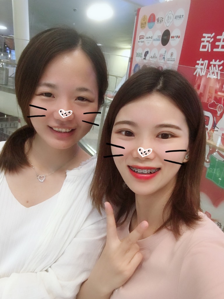 好好好漫长的牙套之路