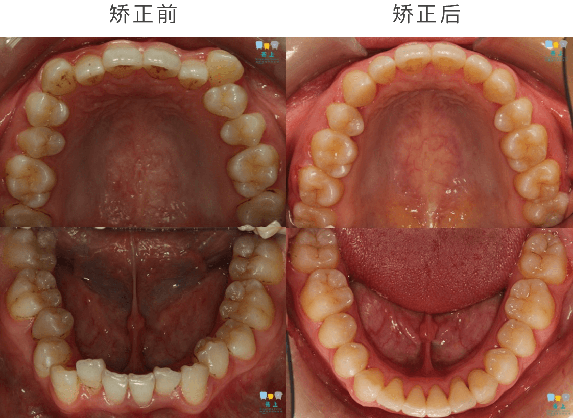 大牙 牙齿,医疗图片素材_高清图片素材