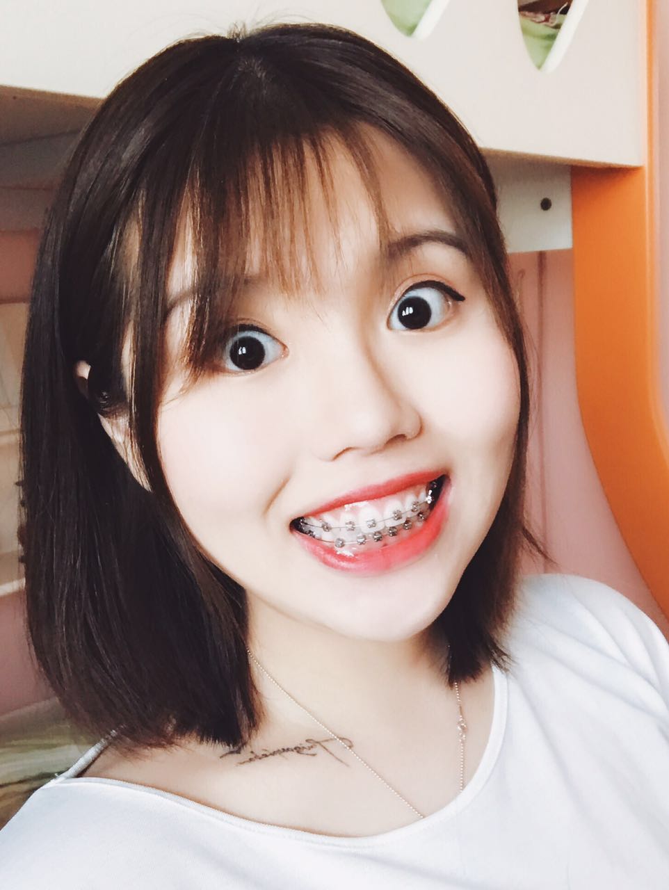 牙套,牙齿上的小饰品!