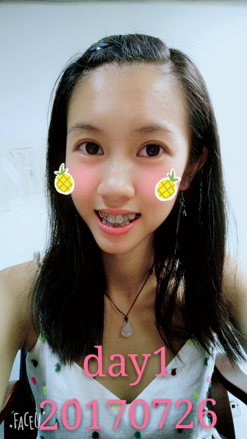 成为小钢牙啦